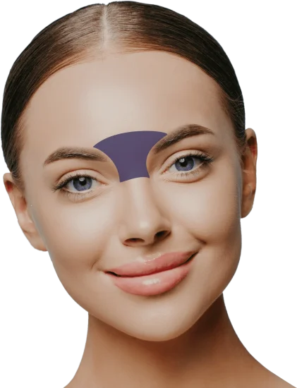 Glabellar